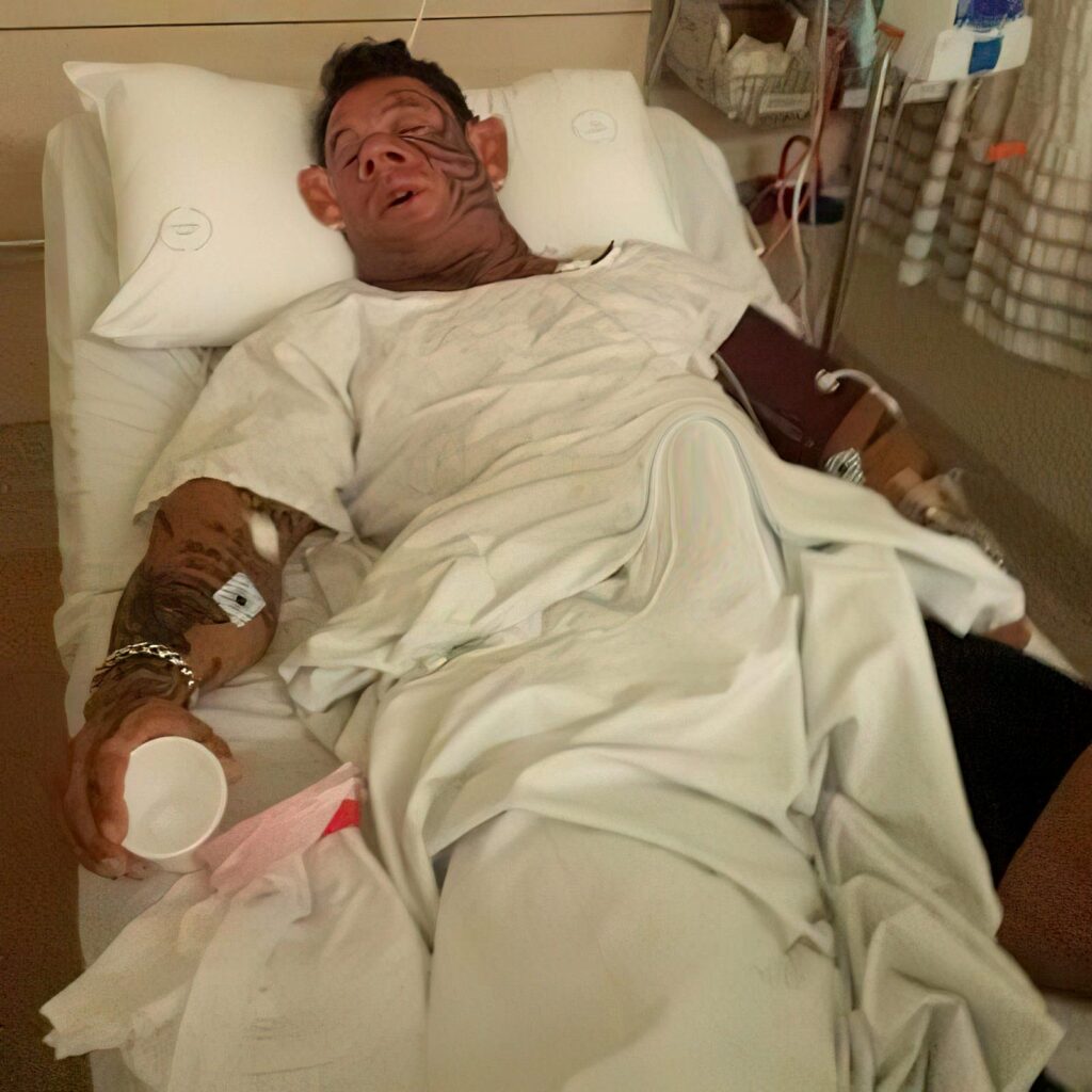 Bodybuilder Lee Priest in a hospital bed. 